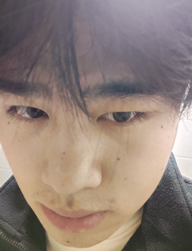 伤男的第一张照片--平顶山残疾人相亲网